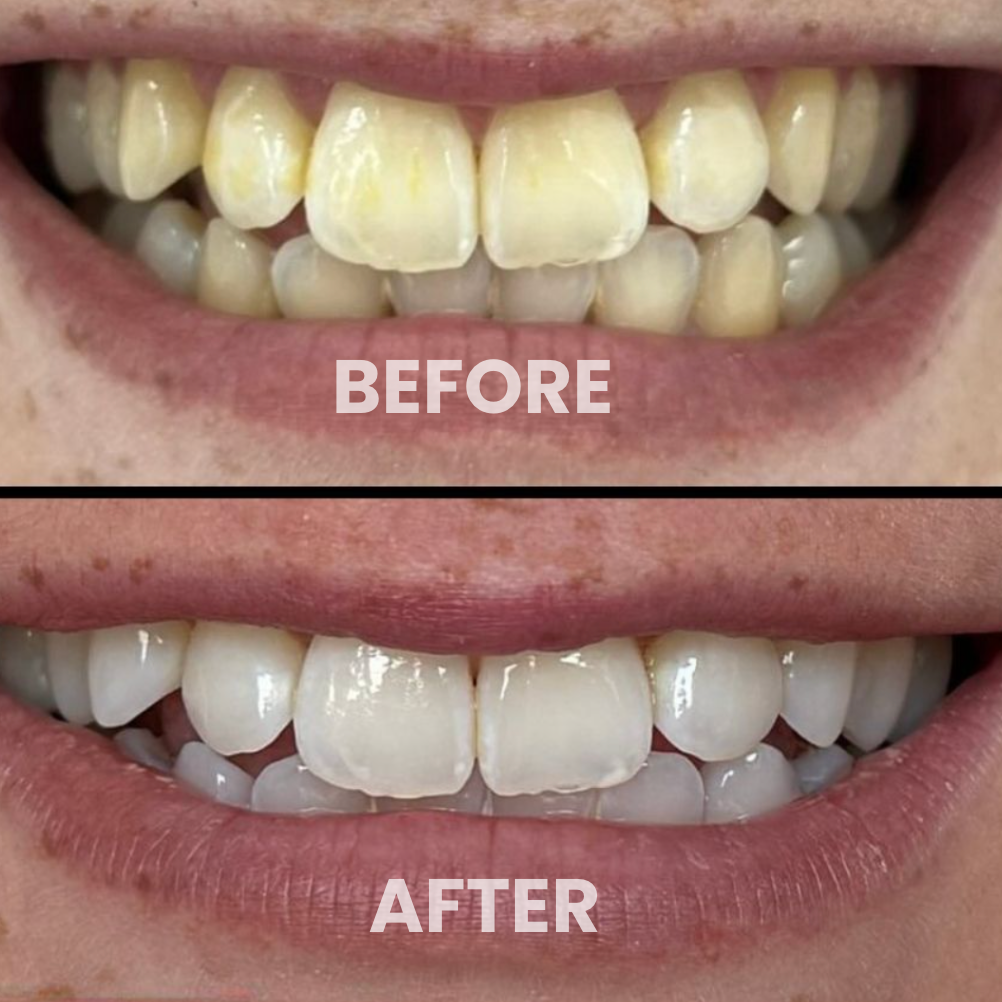 Enamint- color corrector toothpaste