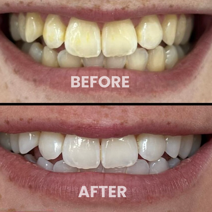 Enamint- color corrector toothpaste